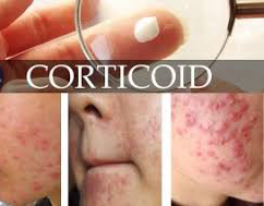 DA NHIỄM CORTICOID (KEM TRỘN) VÀ CÁCH ĐIỀU TRỊ