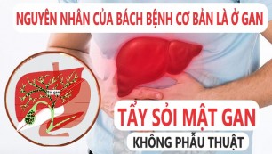 Nguyên Nhân Của Bách Bệnh Cơ Bản Là Ở GAN. Tẩy Sỏi Mật, Gan Không Phẫu Thuật/ Thải Độc Gan